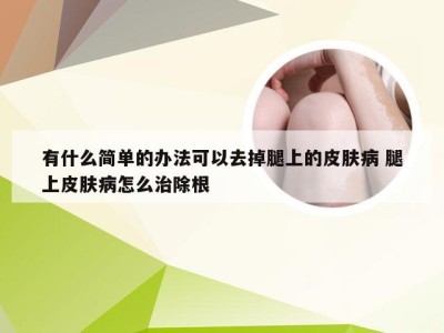 有什么简单的办法可以去掉腿上的皮肤病 腿上皮肤病怎么治除根