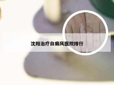 沈阳治疗白癜风医院排行