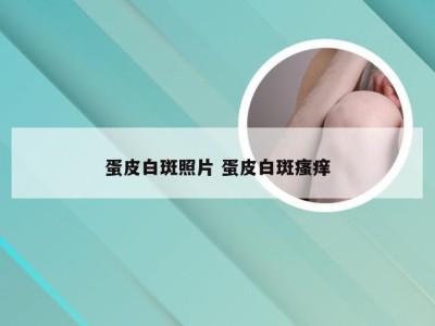 蛋皮白斑照片 蛋皮白斑瘙痒