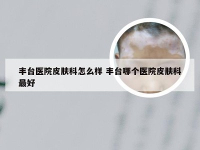 丰台医院皮肤科怎么样 丰台哪个医院皮肤科最好