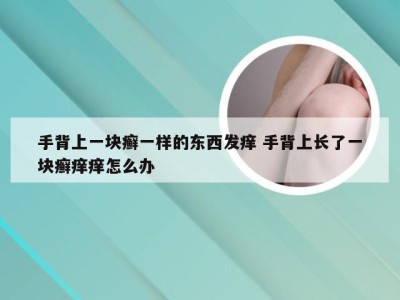 手背上一块癣一样的东西发痒 手背上长了一块癣痒痒怎么办