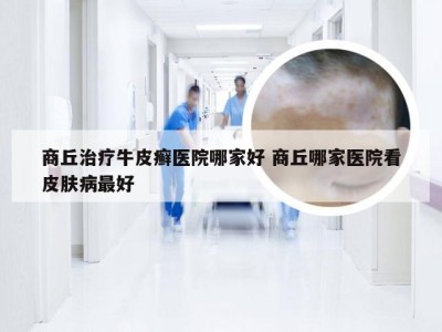 商丘治疗牛皮癣医院哪家好 商丘哪家医院看皮肤病最好