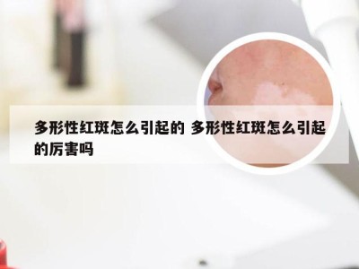 多形性红斑怎么引起的 多形性红斑怎么引起的厉害吗