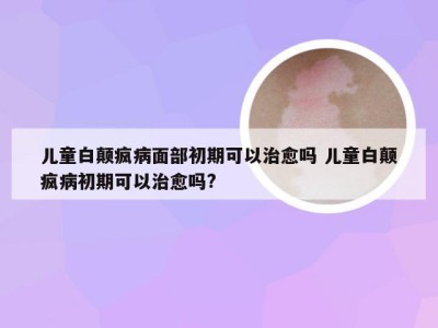 儿童白颠疯病面部初期可以治愈吗 儿童白颠疯病初期可以治愈吗?