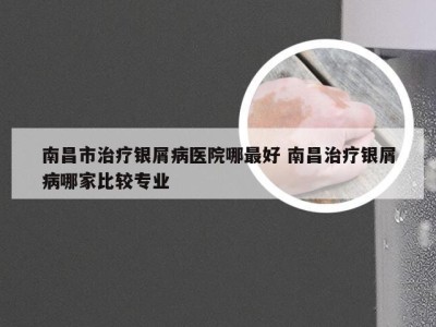 南昌市治疗银屑病医院哪最好 南昌治疗银屑病哪家比较专业