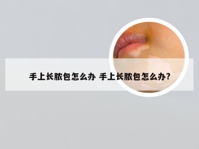 手上长脓包怎么办 手上长脓包怎么办?