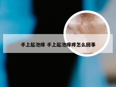 手上起泡痒 手上起泡痒疼怎么回事