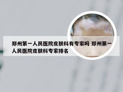 郑州第一人民医院皮肤科有专家吗 郑州第一人民医院皮肤科专家排名