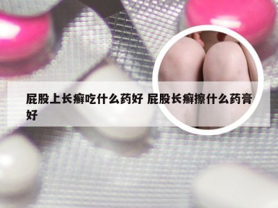 屁股上长癣吃什么药好 屁股长癣擦什么药膏好