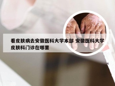 看皮肤病去安徽医科大学本部 安徽医科大学皮肤科门诊在哪里