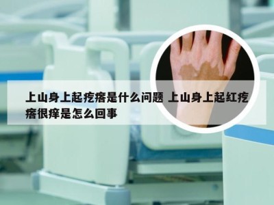 上山身上起疙瘩是什么问题 上山身上起红疙瘩很痒是怎么回事