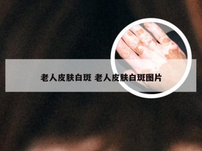 老人皮肤白斑 老人皮肤白斑图片