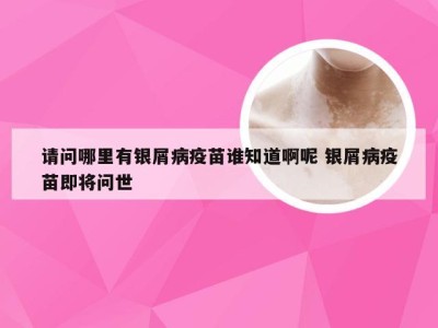 请问哪里有银屑病疫苗谁知道啊呢 银屑病疫苗即将问世