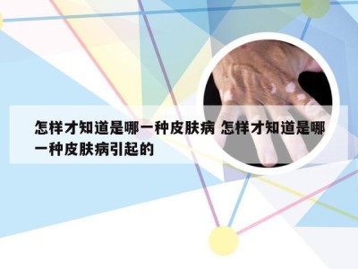 怎样才知道是哪一种皮肤病 怎样才知道是哪一种皮肤病引起的