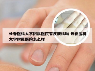 长春医科大学附属医院有皮肤科吗 长春医科大学附属医院怎么样