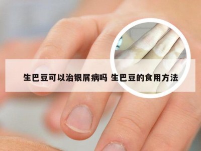 生巴豆可以治银屑病吗 生巴豆的食用方法