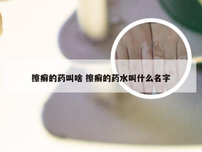 擦癣的药叫啥 擦癣的药水叫什么名字