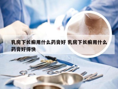 乳房下长癣用什么药膏好 乳房下长癣用什么药膏好得快