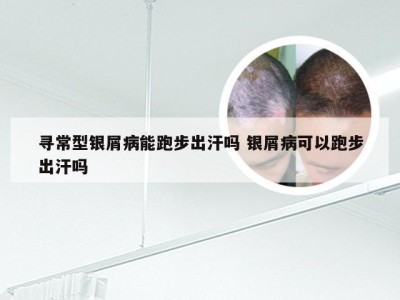 寻常型银屑病能跑步出汗吗 银屑病可以跑步出汗吗