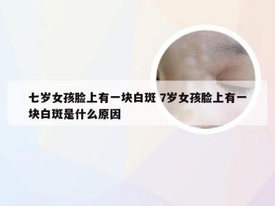 七岁女孩脸上有一块白斑 7岁女孩脸上有一块白斑是什么原因