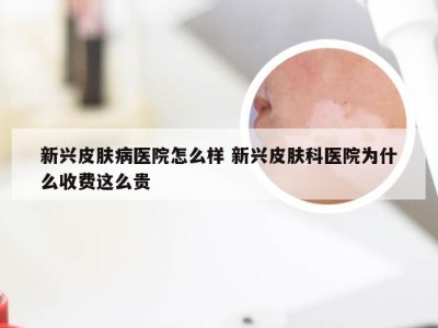 新兴皮肤病医院怎么样 新兴皮肤科医院为什么收费这么贵