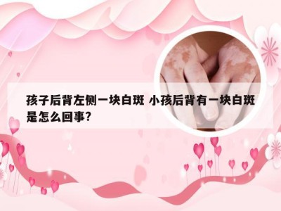 孩子后背左侧一块白斑 小孩后背有一块白斑是怎么回事?