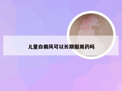 儿童白癜风可以长期服用药吗