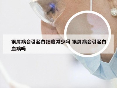 银屑病会引起白细胞减少吗 银屑病会引起白血病吗