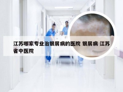 江苏哪家专业治银屑病的医院 银屑病 江苏省中医院