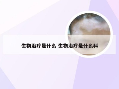 生物治疗是什么 生物治疗是什么科