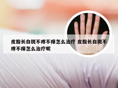 皮股长白斑不疼不痒怎么治疗 皮股长白斑不疼不痒怎么治疗呢