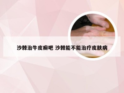 沙棘治牛皮癣吧 沙棘能不能治疗皮肤病