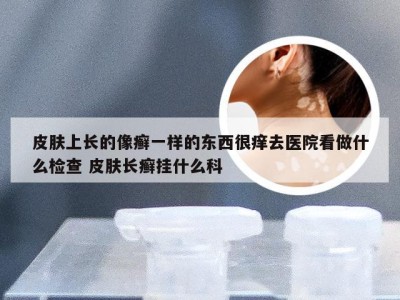 皮肤上长的像癣一样的东西很痒去医院看做什么检查 皮肤长癣挂什么科