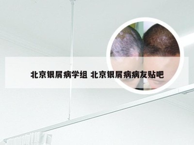 北京银屑病学组 北京银屑病病友贴吧