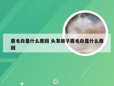 眉毛白是什么原因 头发胡子眉毛白是什么原因