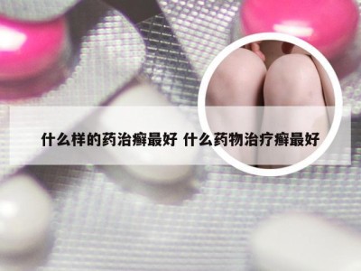 什么样的药治癣最好 什么药物治疗癣最好