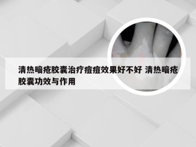 清热暗疮胶囊治疗痘痘效果好不好 清热暗疮胶囊功效与作用