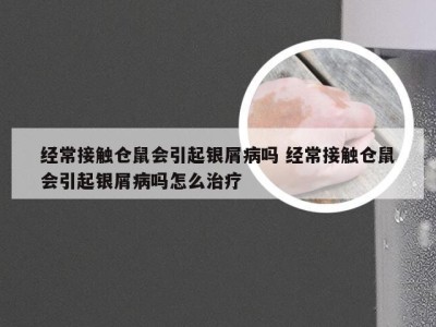 经常接触仓鼠会引起银屑病吗 经常接触仓鼠会引起银屑病吗怎么治疗