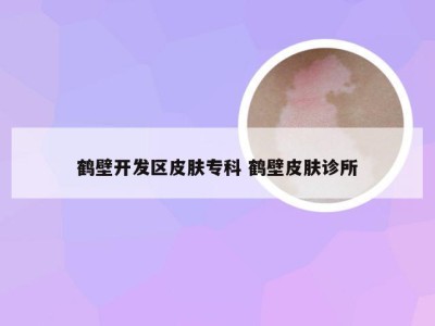 鹤壁开发区皮肤专科 鹤壁皮肤诊所