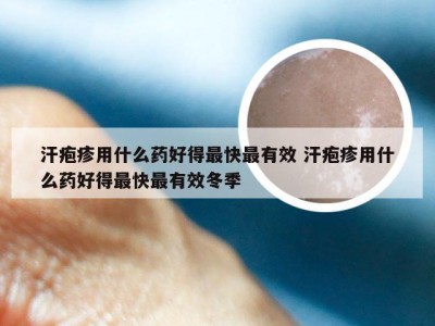 汗疱疹用什么药好得最快最有效 汗疱疹用什么药好得最快最有效冬季