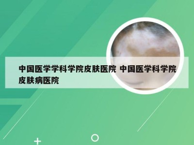 中国医学学科学院皮肤医院 中国医学科学院皮肤病医院