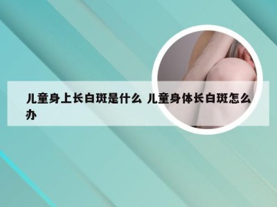 儿童身上长白斑是什么 儿童身体长白斑怎么办