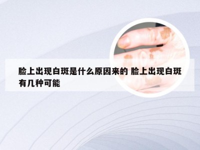 脸上出现白斑是什么原因来的 脸上出现白斑有几种可能