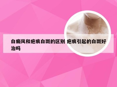 白癜风和疤痕白斑的区别 疤痕引起的白斑好治吗