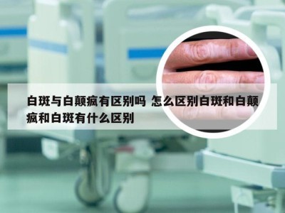 白斑与白颠疯有区别吗 怎么区别白斑和白颠疯和白斑有什么区别