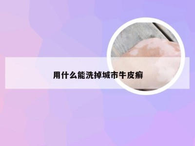 用什么能洗掉城市牛皮癣