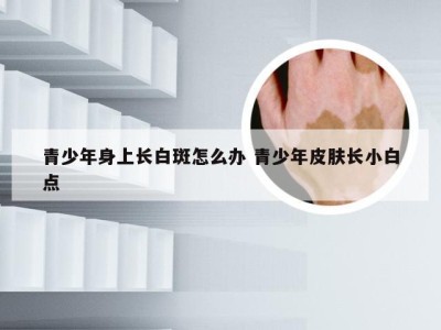 青少年身上长白斑怎么办 青少年皮肤长小白点