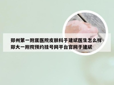 郑州第一附属医院皮肤科于建斌医生怎么样 郑大一附院预约挂号网平台官网于建斌