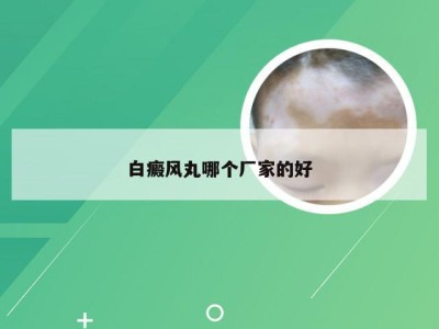 白癜风丸哪个厂家的好