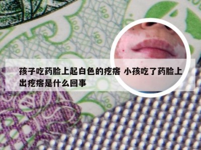 孩子吃药脸上起白色的疙瘩 小孩吃了药脸上出疙瘩是什么回事